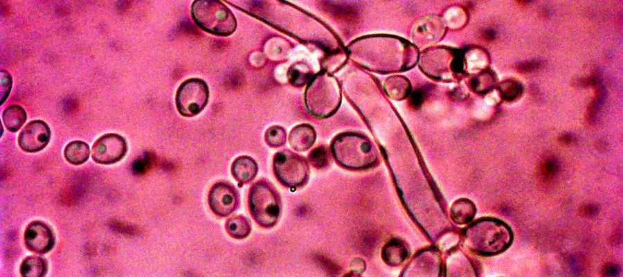Micrograph of Candida albicans