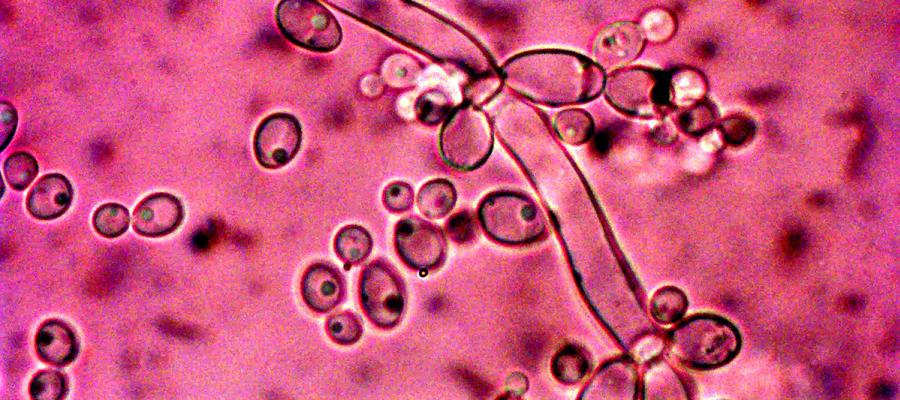 Micrograph of Candida albicans