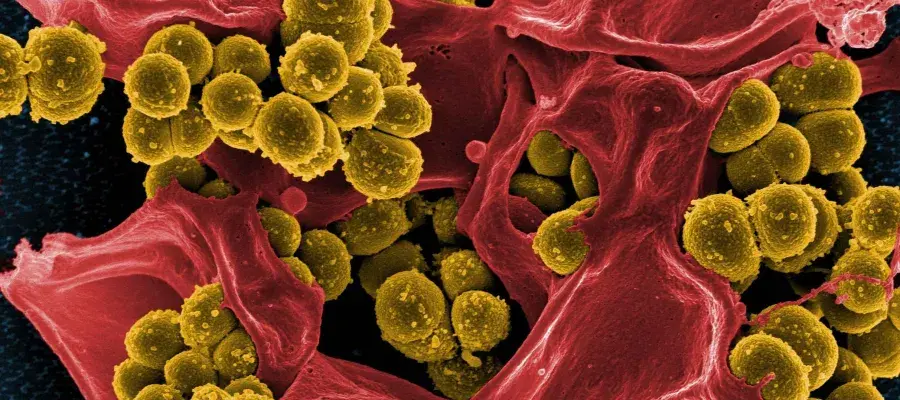 S_aureus_11zon(1).jpg
