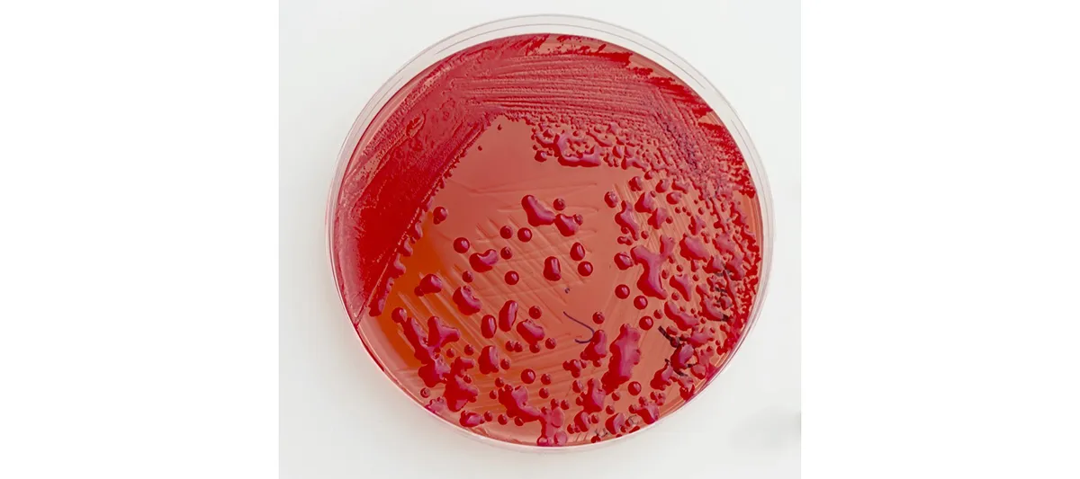Klebsiella on plate