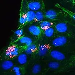 Lawsonia intracellularis