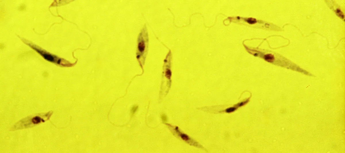 Leishmania tropica parasites