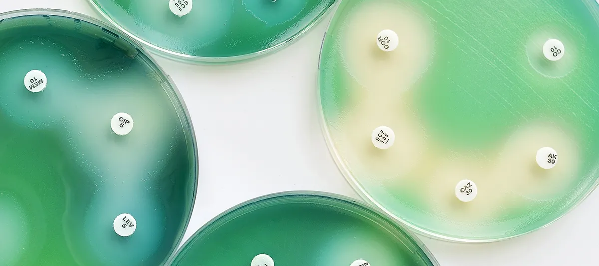 Testing antibiotic sensitivity of Pseudomonas aeruginosa