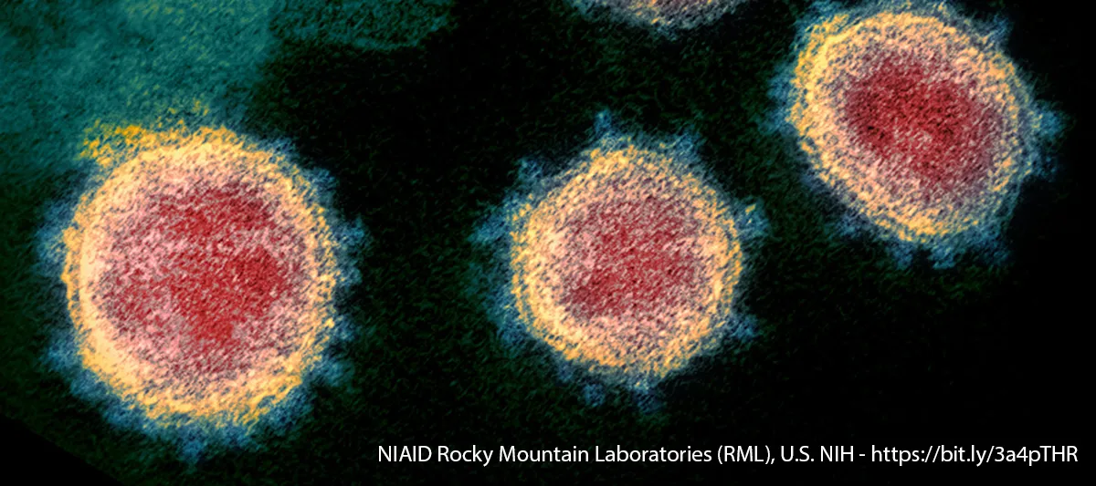 SARS-CoV-2 virus particles