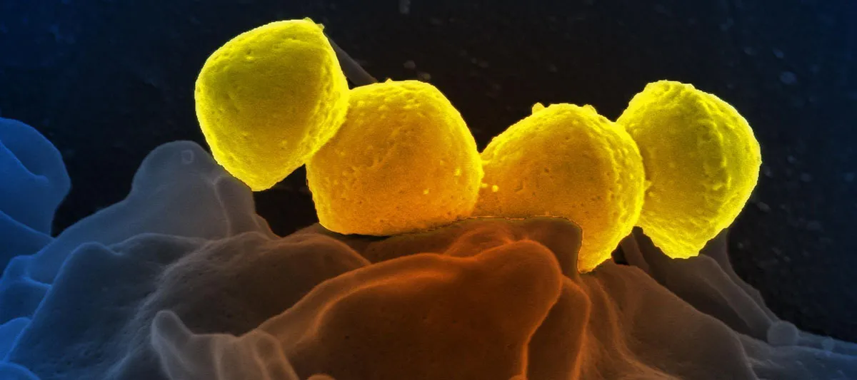 Group A streptococcus on Neutrophil