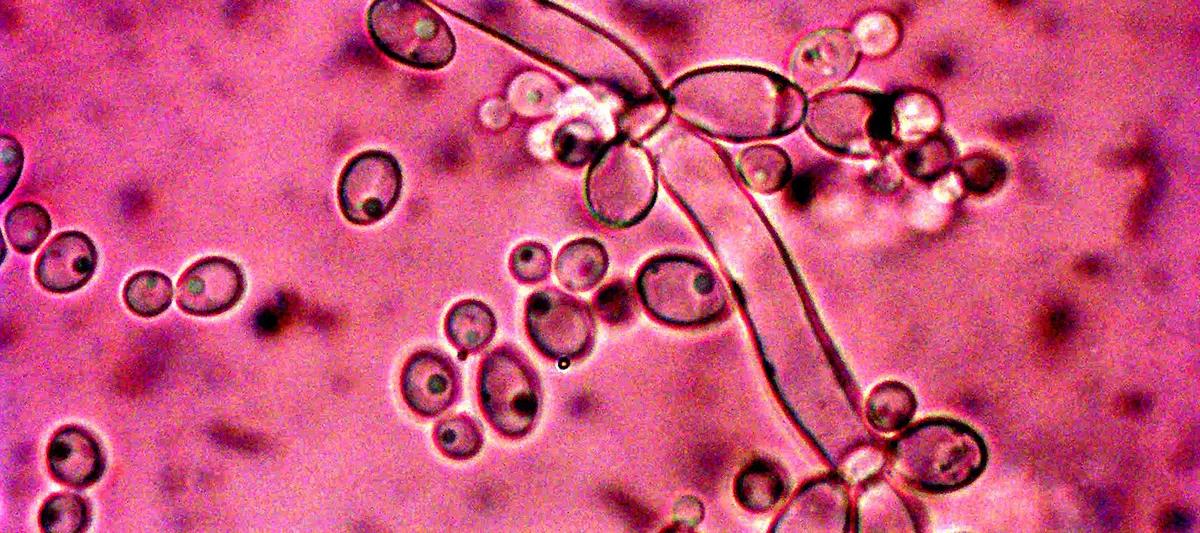 Micrograph of Candida albicans
