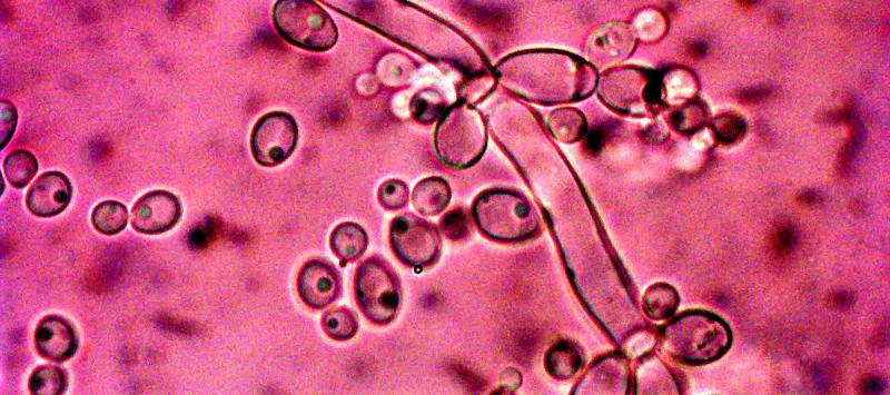 Micrograph of Candida albicans