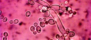 Micrograph of Candida albicans