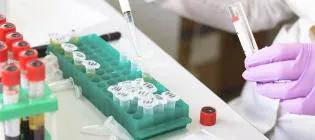 Analysis of samples on a lab bench