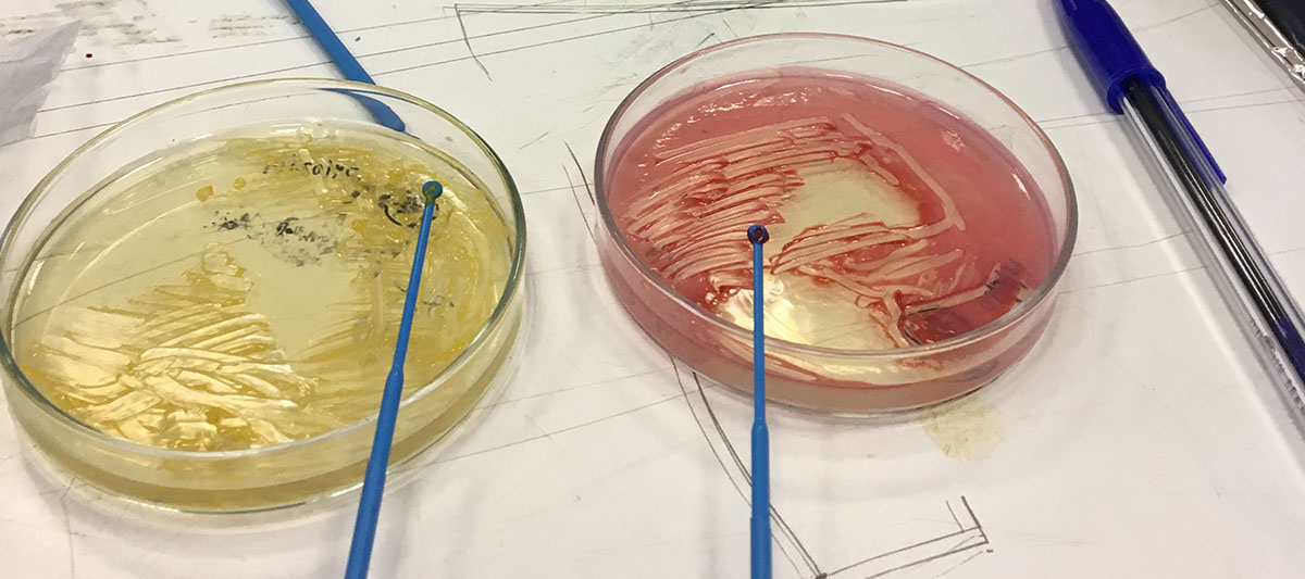 Bacteria spread on petrie dishes