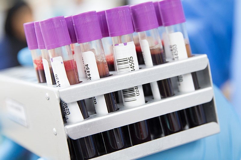 A rack of tubes containing blood samples