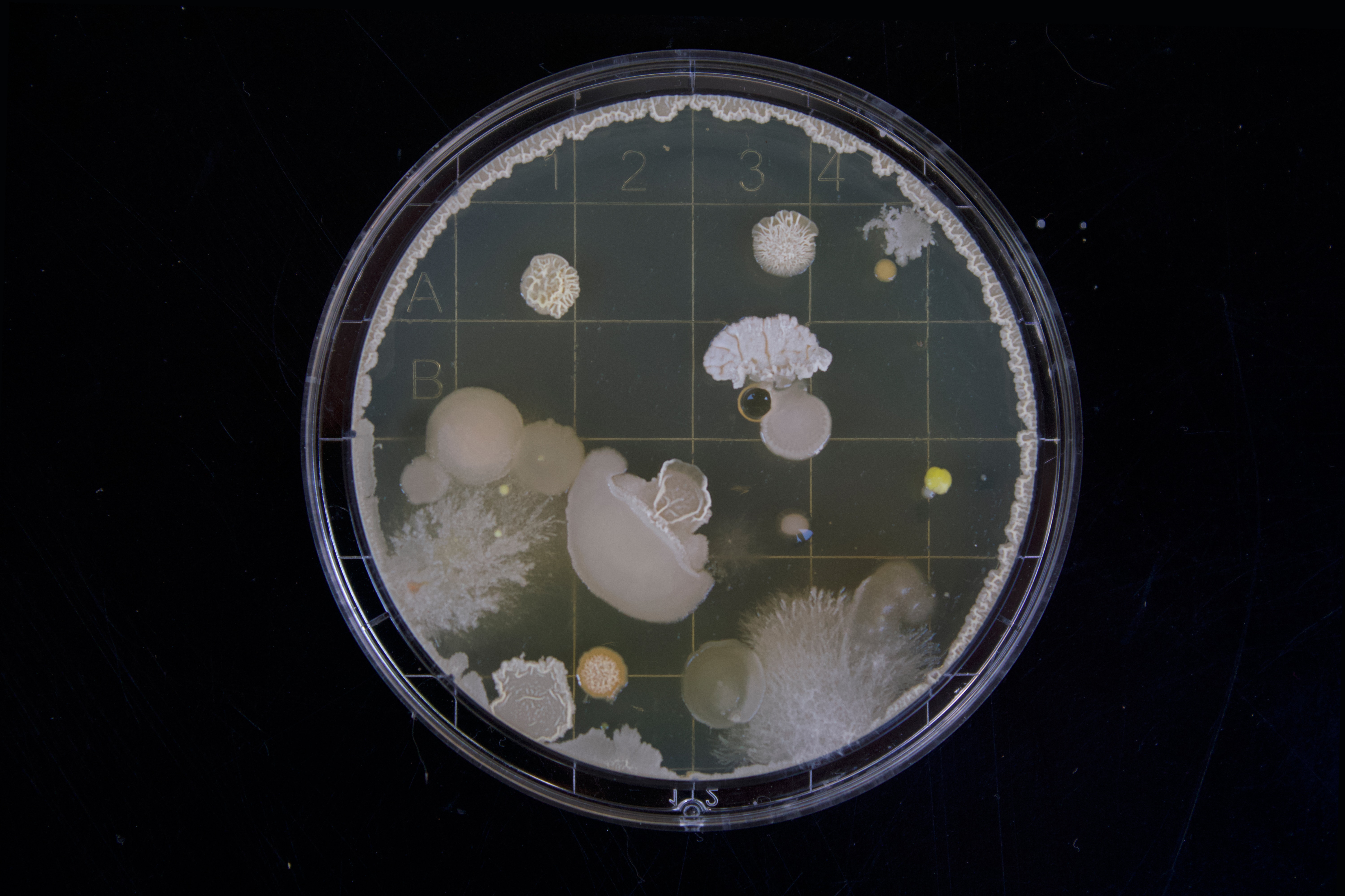 Bacteria Culture