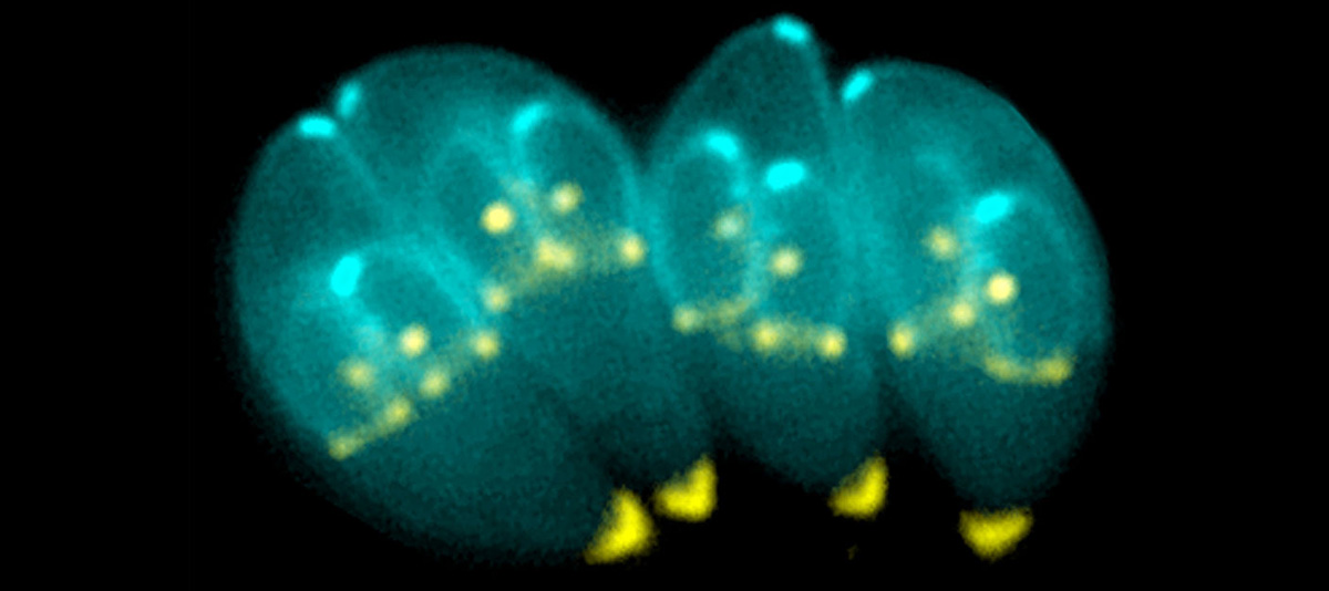 Toxoplasma gondii